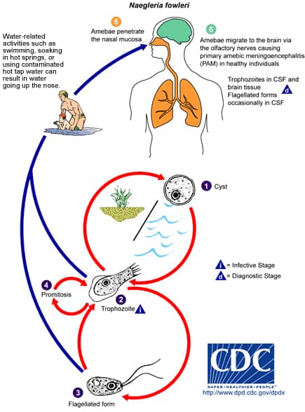 140819AmoebaInfection02