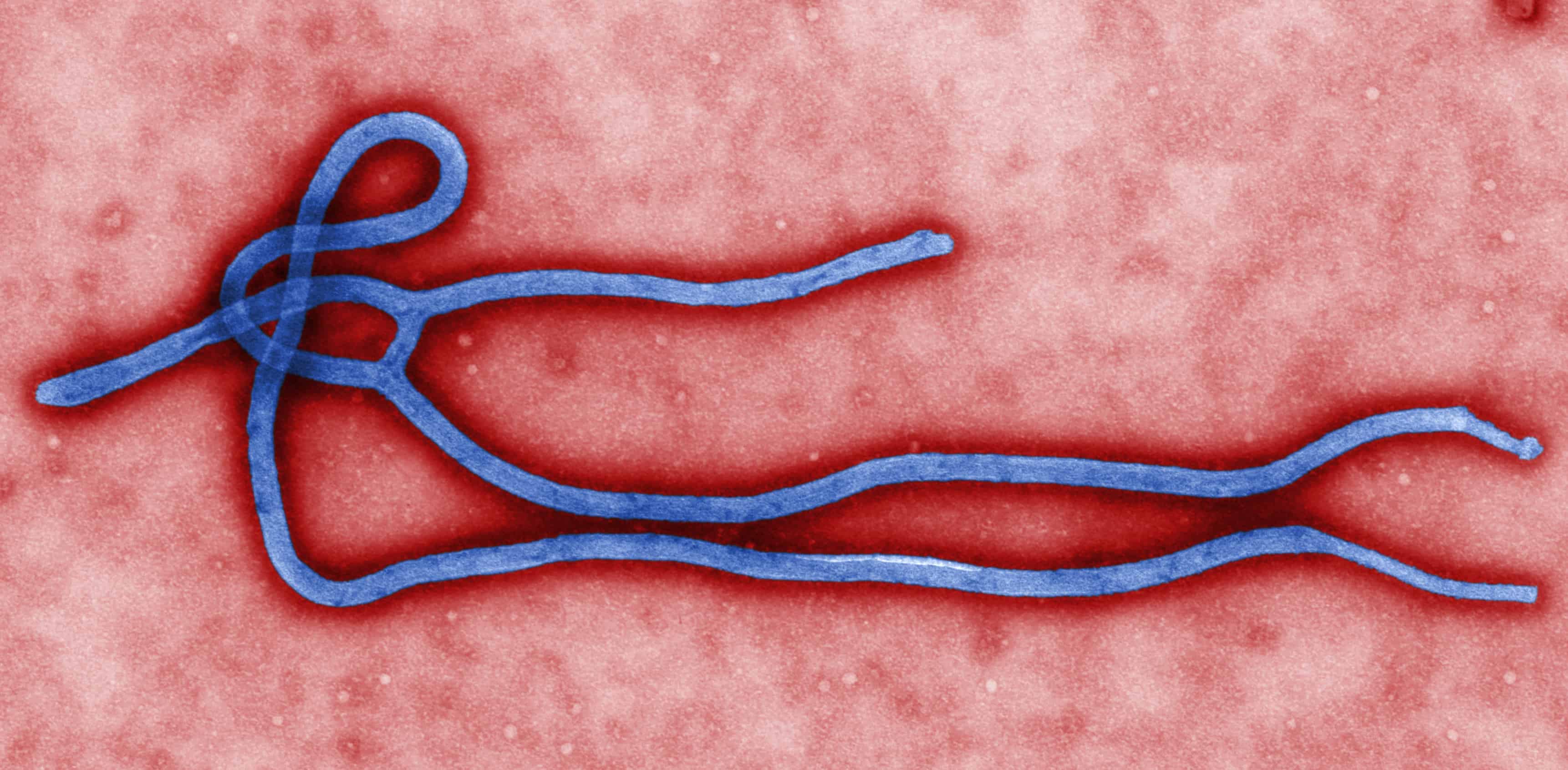 This colorized transmission electron micrograph (TEM) obtained March 24, 2014 from the Centers for Disease Control in Atlanta, Georgia, reveals some of the ultrastructural morphology displayed by an Ebola virus virion.