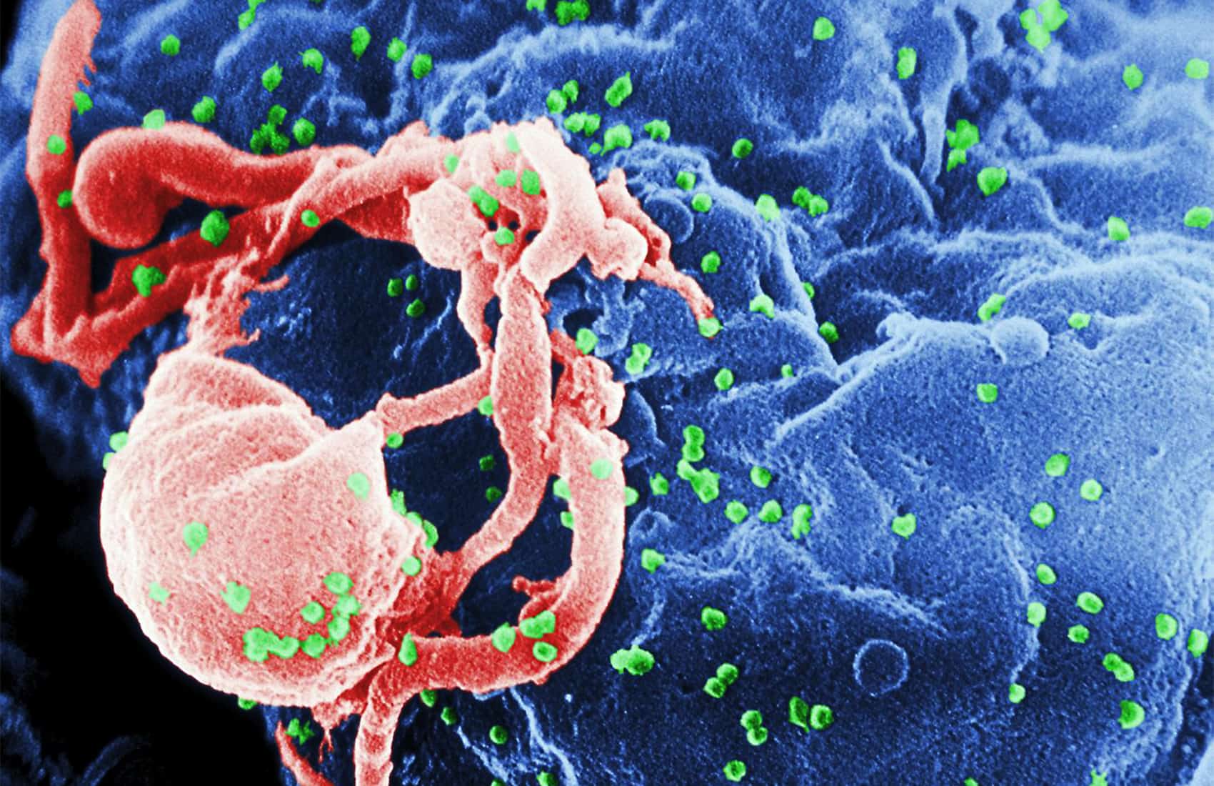 HIV photo