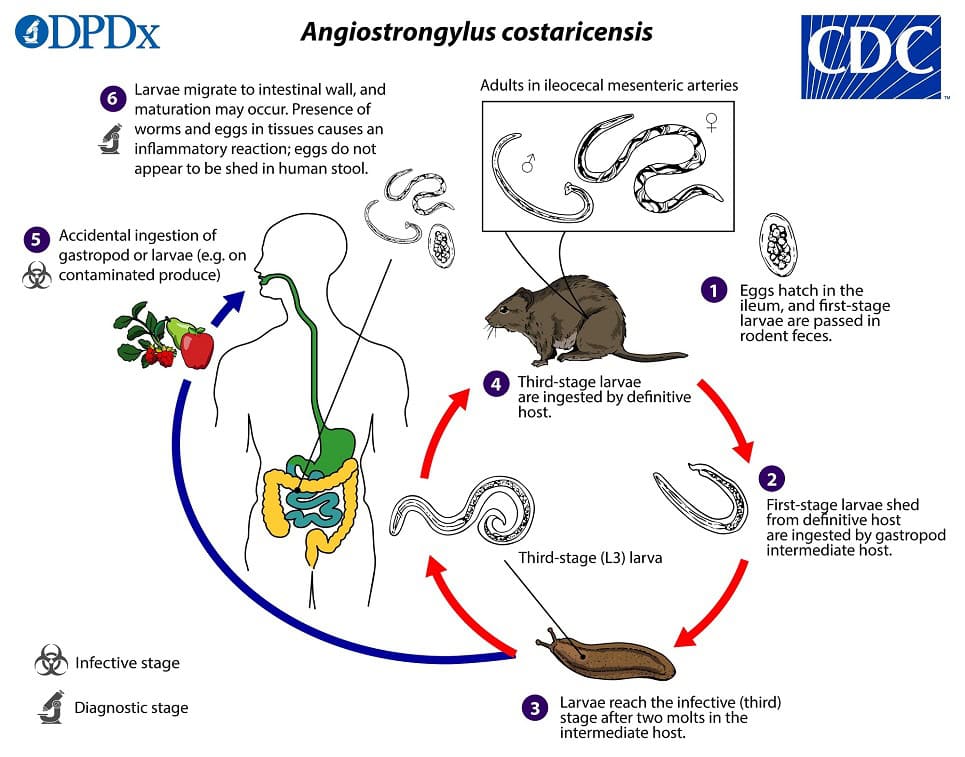 The Rare Costa Rica Parasite That Sent Me to Surgery